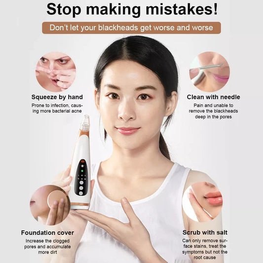 Mini USB Blackhead Remover