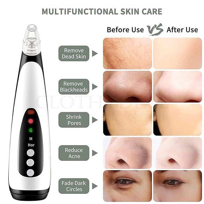 Mini USB Blackhead Remover